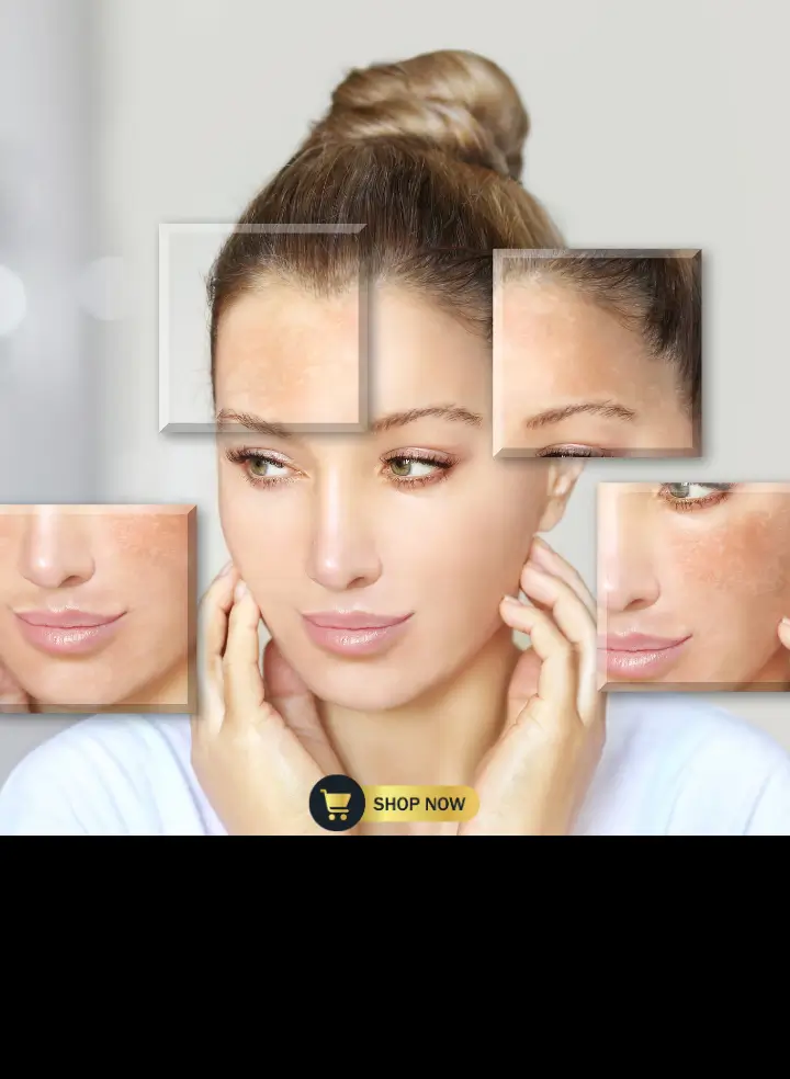Skin Concern